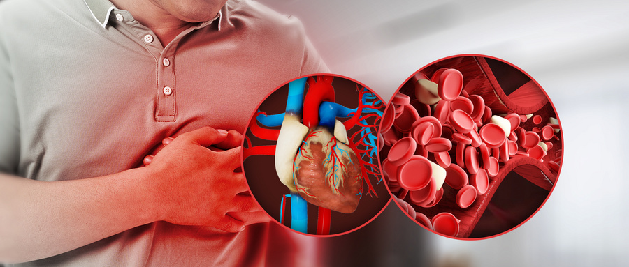 心肌炎的症状有哪些 出现心肌炎要做哪些检查