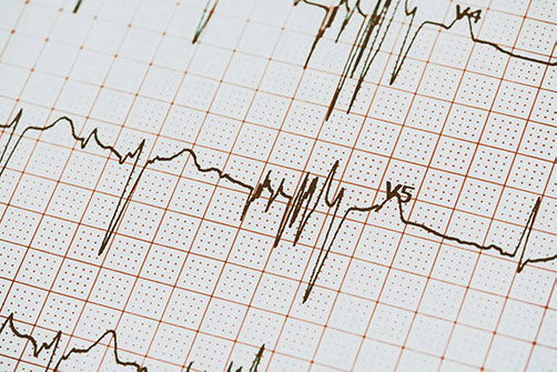 心脏突然“咯噔”一下是咋回事，是心脏病前兆吗？