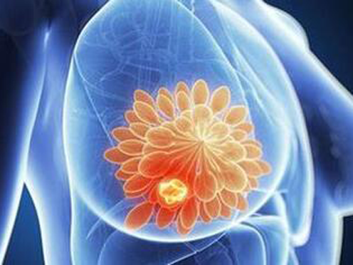 乳腺疾病可以做哪些检查